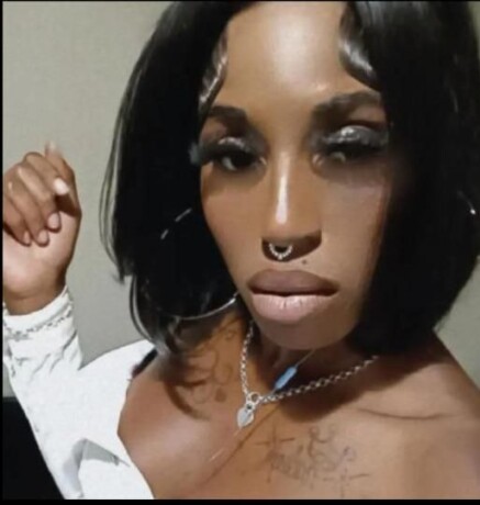 head-surgeon-pussy-fairy-dys-female-escorts-in-philadelphia-pa-267-684-5024-big-3